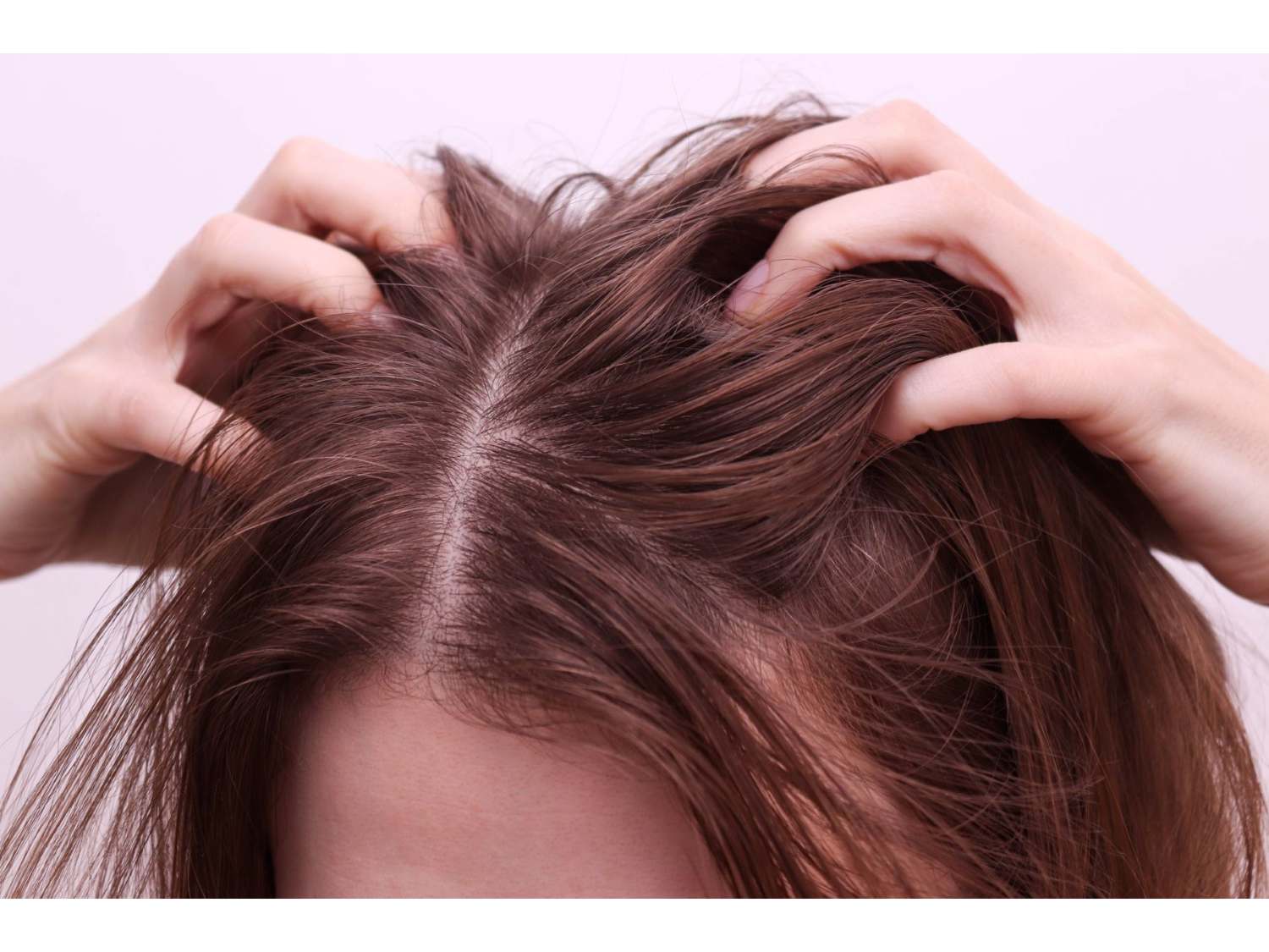 Itchy Scalp Thinning Hair Female